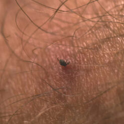 Lifesystems Tick Removal Tool